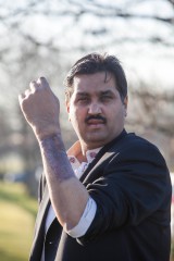 Mohammed Abad's willy and one testicle were ripped off during a horror car accident when he was just six. Pic of the area on his arm used for the skin graft.